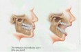 /album/tmj-occlusion/tmj-4-jpg/